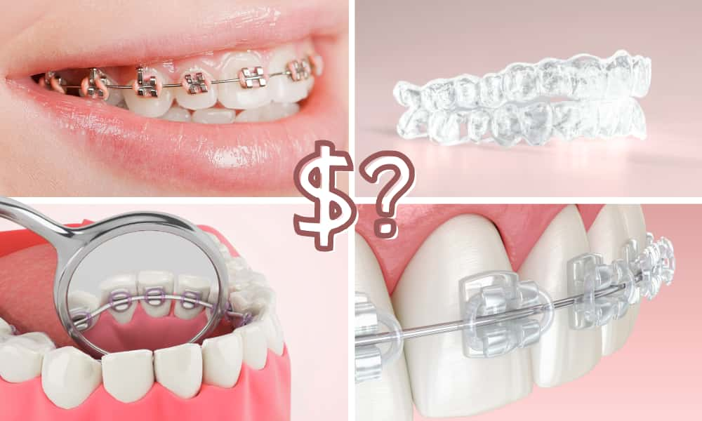 All Types of Braces and Their Prices in Malaysia: A Complete Guide