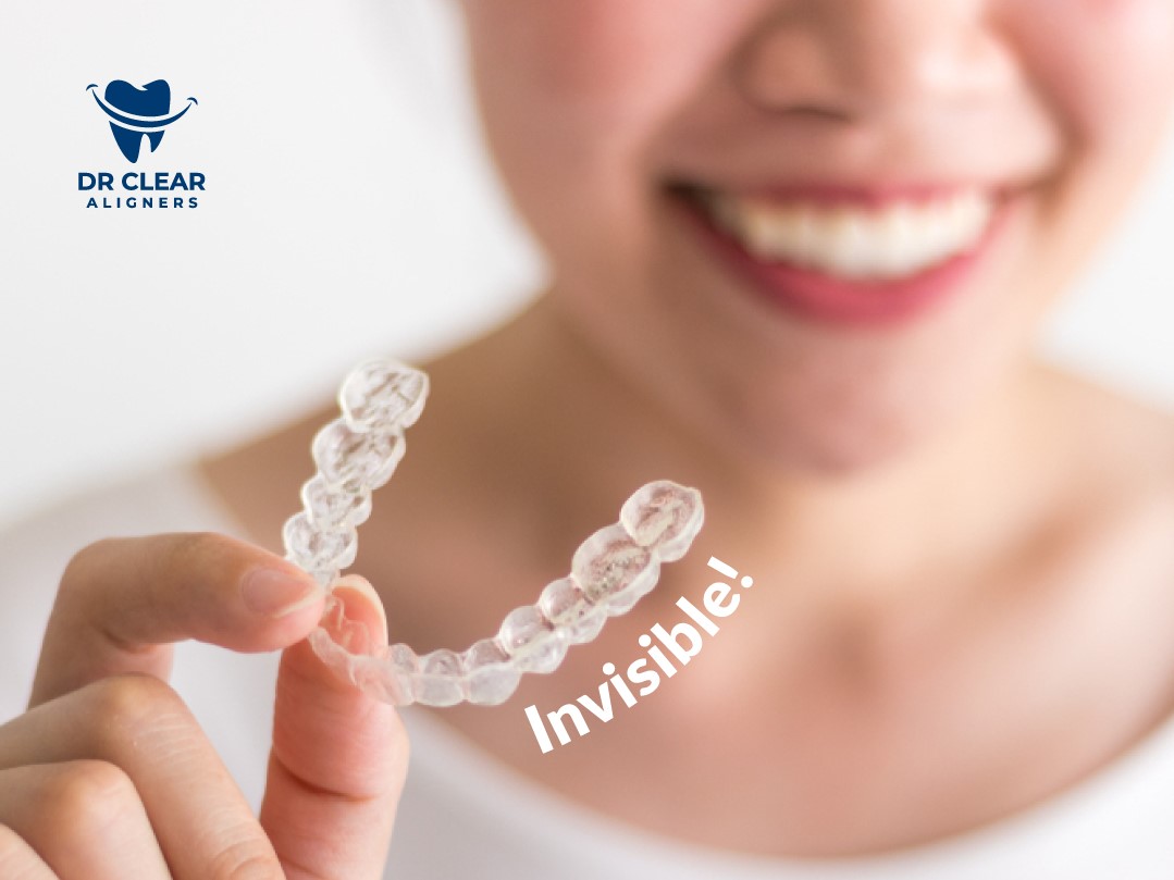 What is Invisalign and 6 Compelling Reasons to Choose Them
