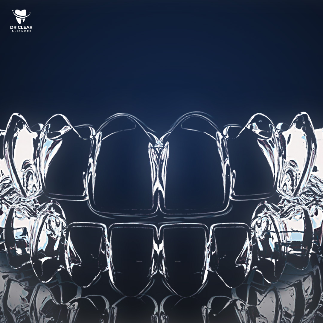 Custom-Fit Clear Retainers + 1 Box Cleaning Tablet 3 set - Image 4